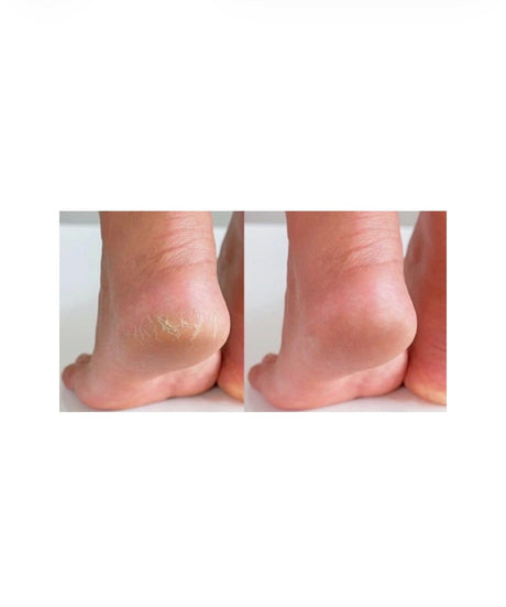 Before/After
